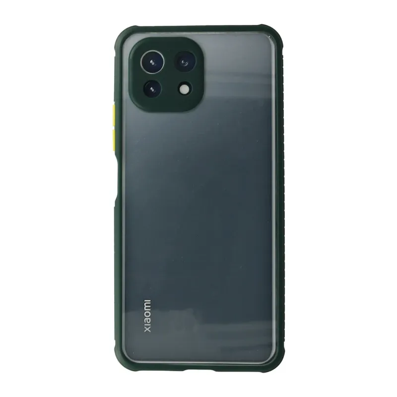 Xiaomi Mİ 11 Lite Kılıf Miami Şeffaf Silikon - Koyu Yeşil