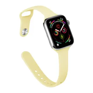 Apple Watch 38mm Klasik Kordon - Sarı