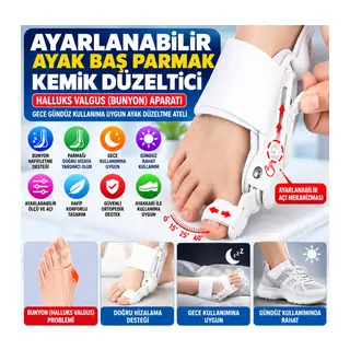 Ayarlanabilir Ayak Baş Parmak Kemik Düzeltici – Halluks Valgus (Bunyon) Aparatı, Gece Gündüz Kullanıma Uygun Ayak Düzeltme Ateli