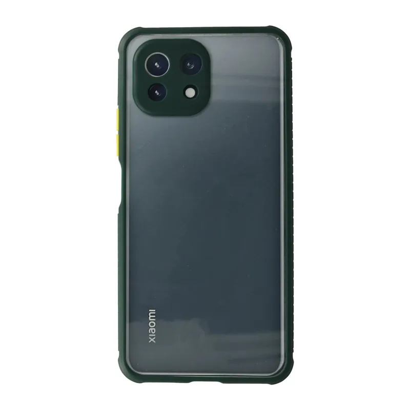 Xiaomi Mİ 11 Lite Uyumlu Kılıf Miami Şeffaf Silikon - Koyu Yeşil