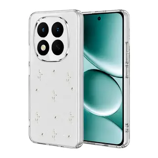 Xiaomi Redmi Note 15 Pro 5G Uyumlu Fiyonk Desenli Kapak - Desen 4