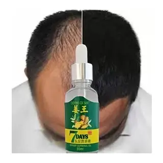 7days 30ml Gingergerminalessentialoil Hair Growth Loss Treatment Serum Unisex Saç Bakım Yağı