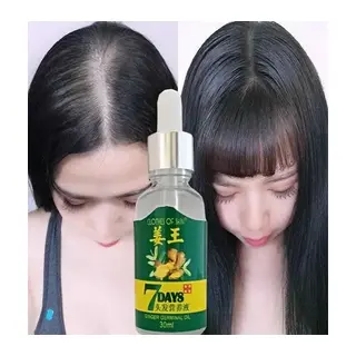 7days 30ml Gingergerminalessentialoil Hair Growth Loss Treatment Serum Unisex 3 Adet Saç Bakım Yağı