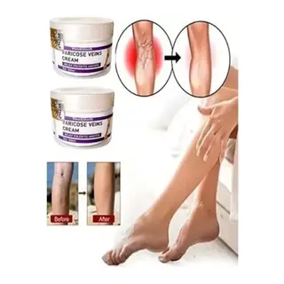 V.ricose And Spider Vns Sthing Leg Cream Bacak Bakım Kremi 100 Ml X 2 Adet