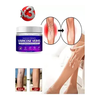 Süper Maximum Strngth Varcse Vnis Bakım Kremi 100 Ml X 3 Adet