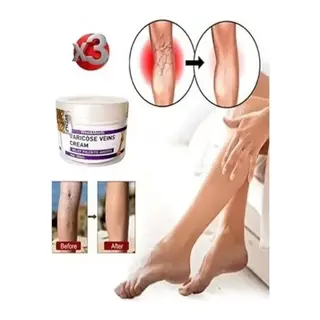 V.ricose And Spider Vns Sthing Leg Cream Bacak Bakım Kremi 100 Ml X 3 Adet
